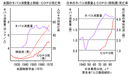 COPD in Japan